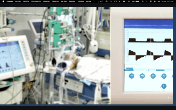 PACK Cursos Ventilación Mecánica: VM No invasiva + VM Aplicada (invasiva) - Imagen 2